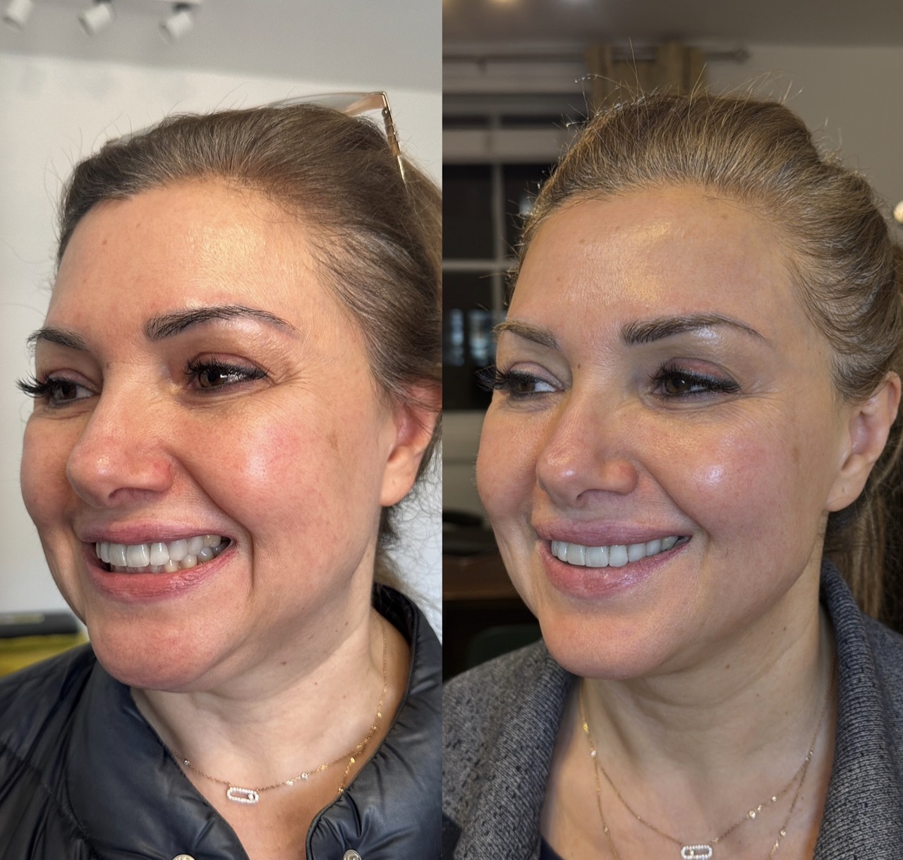Treatment room for scar and texture treatment at Harmony Medical