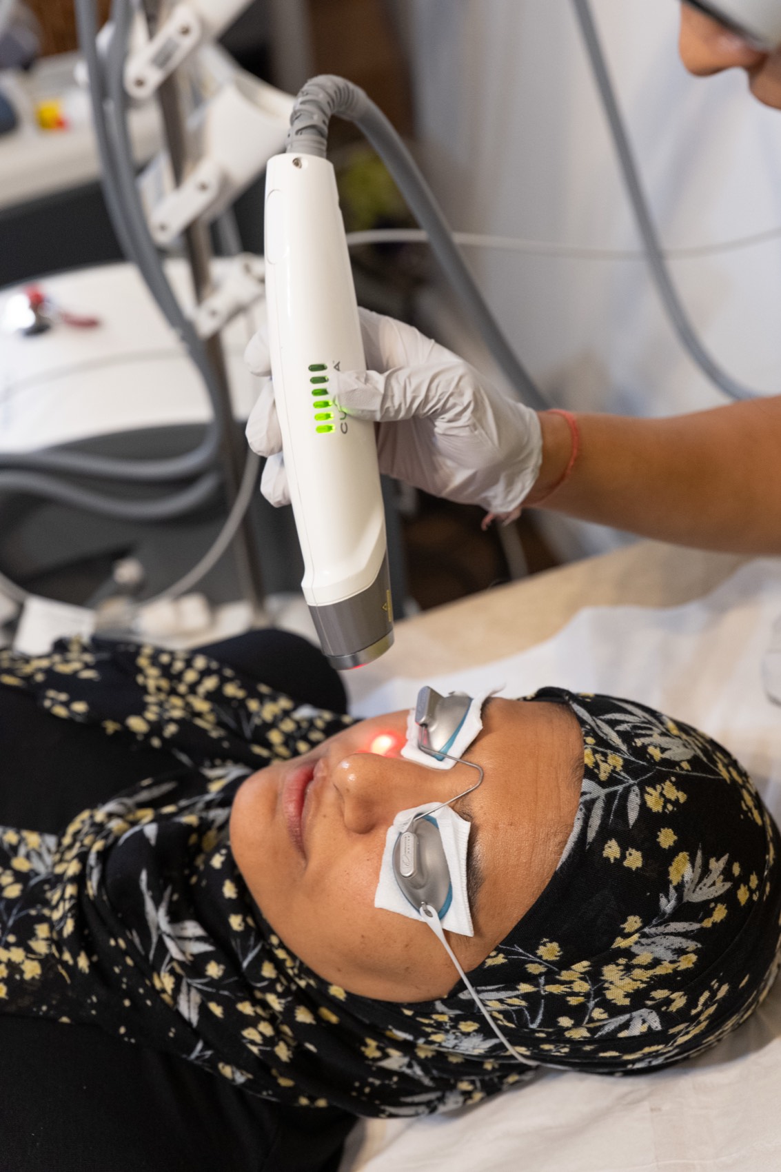 Laser treatment for acne at Harmony Medical