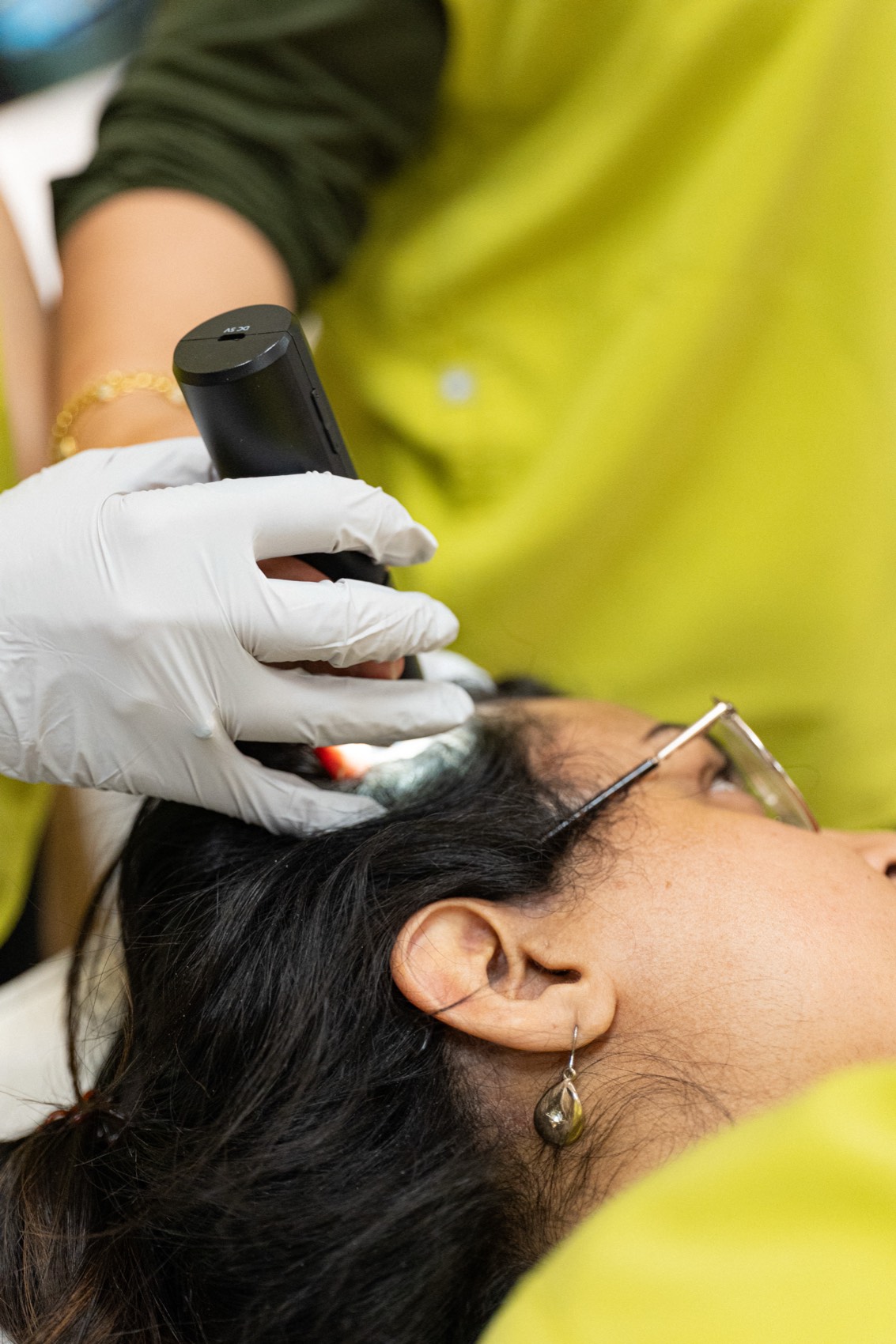 Assessment and laser treatment for pigmentation at Harmony Medical