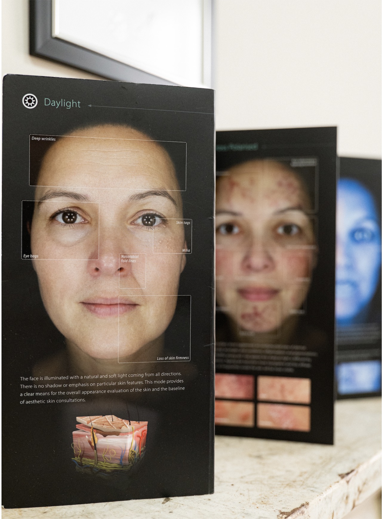 Skin analysis at Harmony Medical, Halifax and London