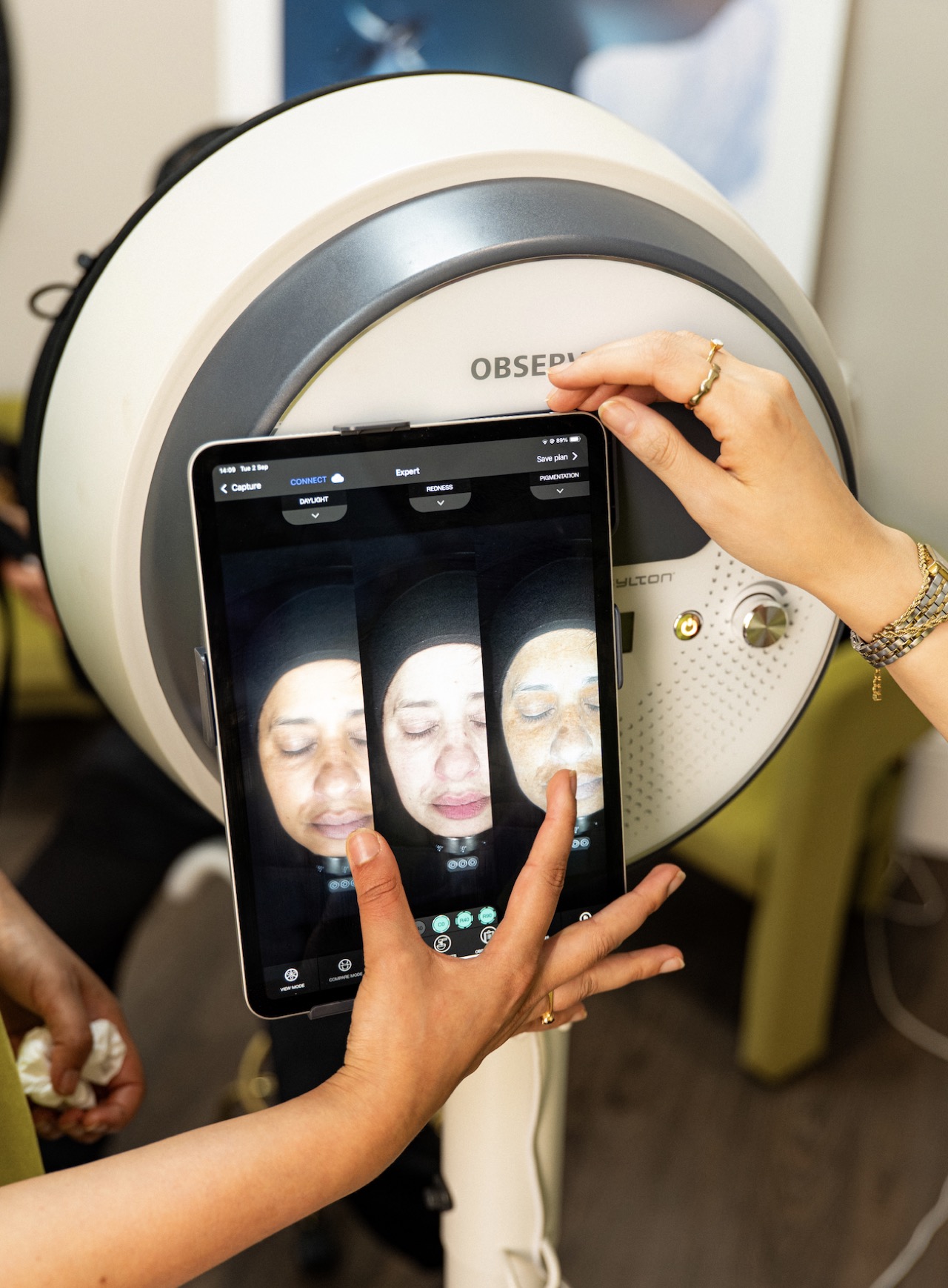 Observ skin scanning at Harmony Medical, Halifax and London