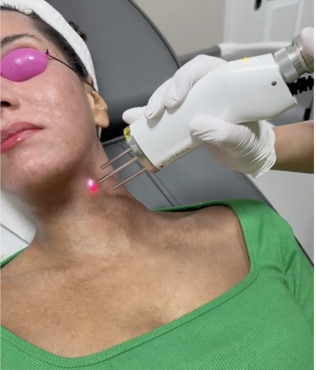 Skin concerns and lasers at Harmony Medical